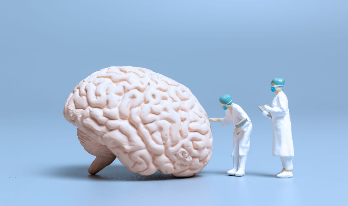 Miniatures de scientifiques examinant un cerveau géant
